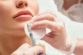 ماندگاری تزریق ژل لب چه مدت است؟1