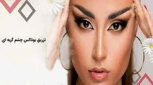 تزریق-بوتاکس-چشم-گربه-ای321