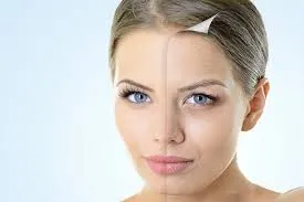 سفت شدن پوست صورت در یک هفته با روش‌های مختلف5